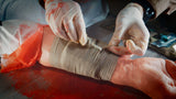 Hartmann Trauma Bandage -15cm